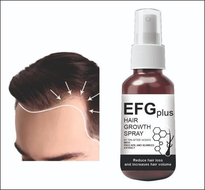 EFGPLUS Hair Growth Spray 50ml (Pack of 2)